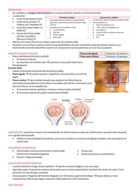 Fisura Anal Fiorela Cachay Udocz