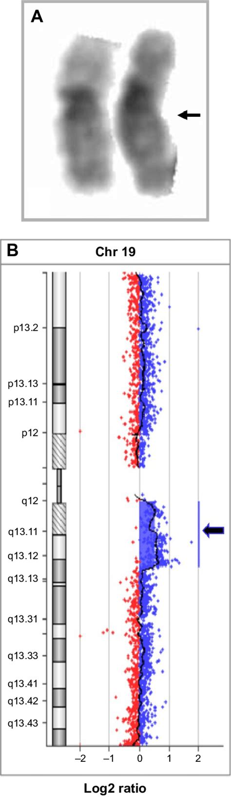 Cytogenetic And Array Cgh Characterization Notes A Probands