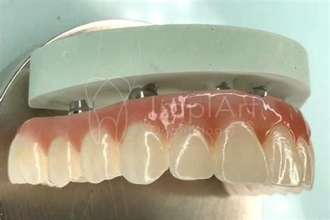 Protocolo em Zircônia Implante Completo Zirconia ImplArt