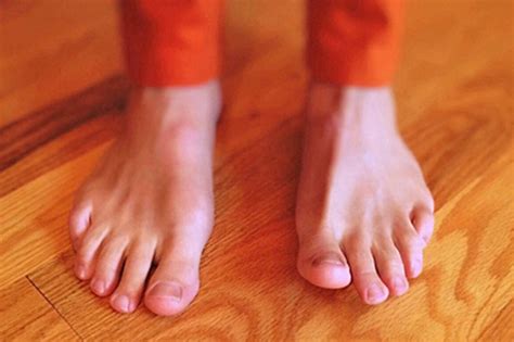 Higiene Y Cuidado De Los Pies Fundamental En Personas Con Diabetes