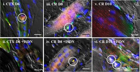 Frontiers Preliminary Study Of S100b And Sema3a Expression Patterns