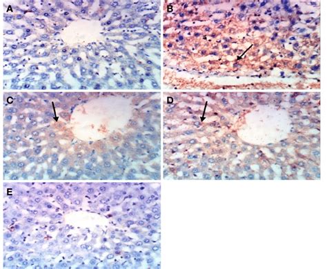 Immunohistochemical Staining Of Caspase 3 In Liver Control Group Download Scientific Diagram