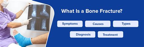 What is Bone Fracture : Its Symptoms, Causes, Types, Diagnosis And ...