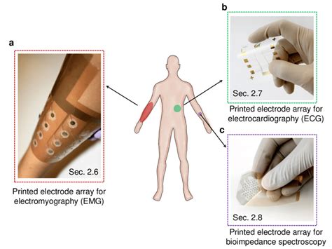 1 Printed Electrodes For Biopotential And Bioimpedance Measurements