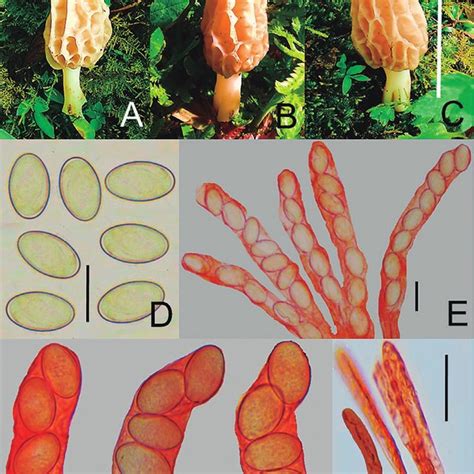 Registro Fotográfico Macroscópico Y Microscópico De Morchella Sp A