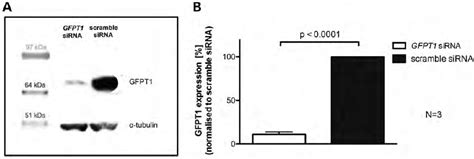 Gfpt Expression In Gfpt Sirna Knock Down And Wild Type Te Db