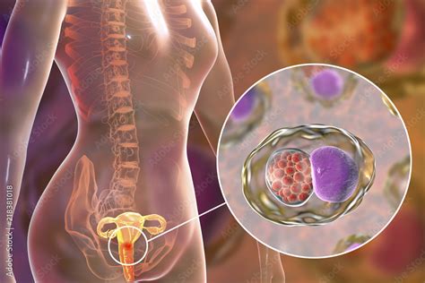 Female Chlamydiosis Medical Concept 3D Illustration Showing Close Up