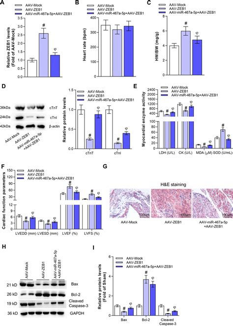 ZEB1 Inhibits MI In Mice And MiR 467a 5p Rescued The Effects Of ZEB1 In