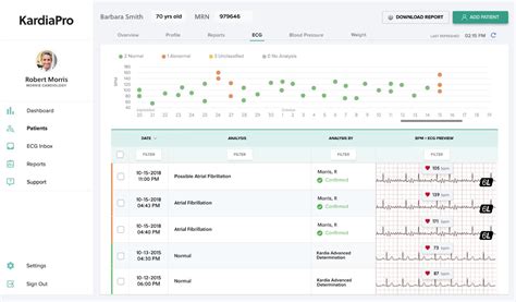 KardiaMobile ECG Integrates With Epic EHR Via App Orchard Marketplace