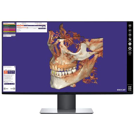 Módulo de software hospitalar DICPDCAD exocad GmbH odontológico