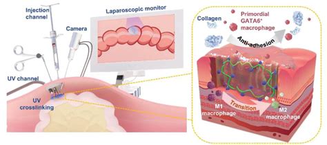 Newly Developed Injectable Adhesive Surgical EurekAlert