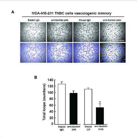 In Vitro Vasculogenic Mimicry By Es Ovarian Cancer Cells And By