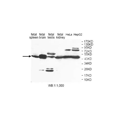 ENO2 Antibody Supplier CAS AOBIOUS