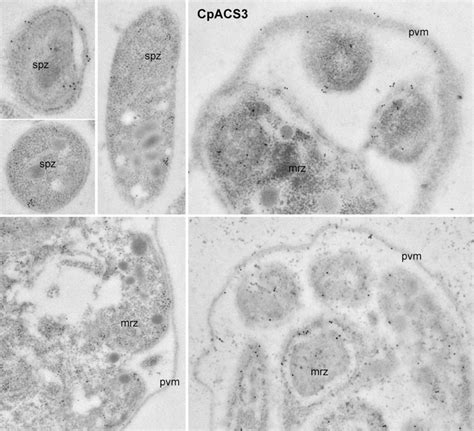 Colloidal Gold Immuno Electron Microscopic Labeling Of Cpacs Protein