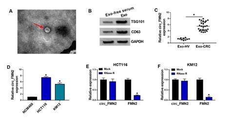 Exosomes Identification And The Expression Of Circ Fmn A The