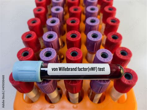 Blood Sample For Von Willebrand Factor Vwf Antigen Test Clotting