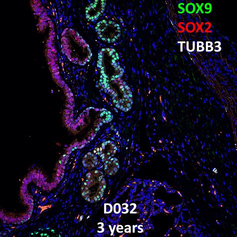 Year Old Old Human Lung Confocal Imaging Sox Sox And Tubb