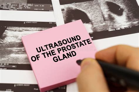 On the Ultrasound Pictures There are Stickers that Say - Ultrasound of ...