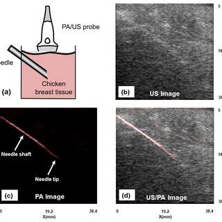 A Illustration Showing The Angle Of Needle Insertion And Position Of