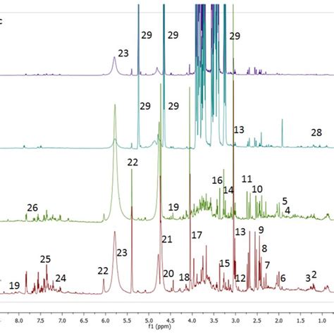 Representative Of Mhz H Nmr Spectra Of Urine Samples For Normal