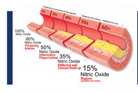 Nitric Oxide For Your Health And Why It Is Important Victory Mens