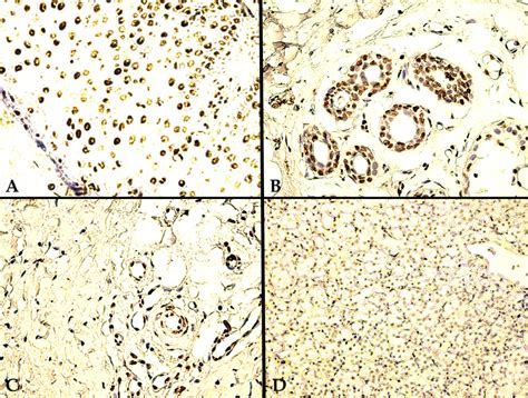 External Positive Control Negative Rcc Td Targeted Ihc Staining A