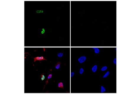 TUNEL Assay Kit (Fluorescence, 488 nm) | Cell Signaling Technology