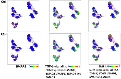 BMPR2 TGF β signaling genes and Endothelial to Mesenchymal Transition