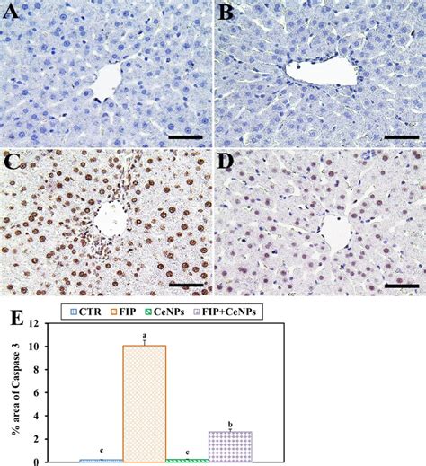 Immunohistochemical Staining Of Rat Liver By Caspase3 A Negative Download Scientific Diagram