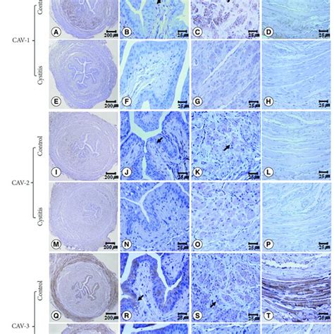 Immunohistochemistry Of Caveolin Cav A H Cav I P And Cav