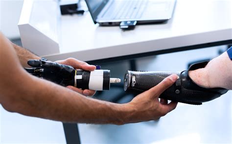 Prosthetics And Orthotics Market Research Report 2027 MTI