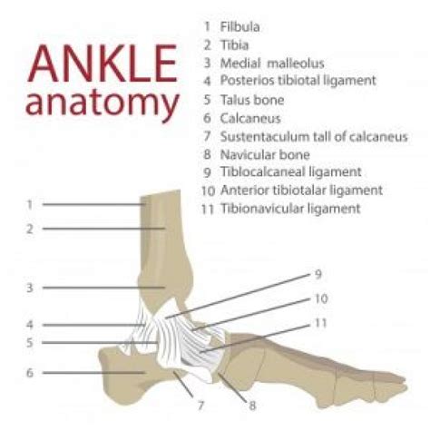 Compound Fracture Diagram