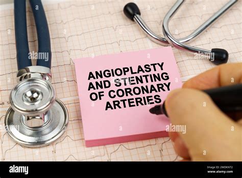 Coronary Arteries Hi Res Stock Photography And Images Alamy