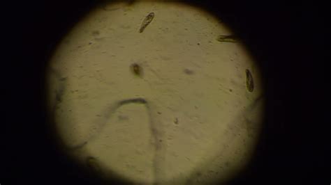 Paramecium Caudatum considering the microscope. Paramecium Caudatum ...