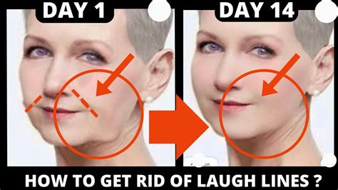 🛑 Laugh Lines Facial Exercises Nasolabial Folds Jowls Saggy Skin