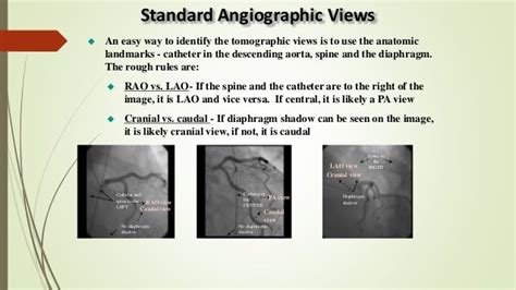 Cag Interpretation Dr Shiva Ctvs Jipmer