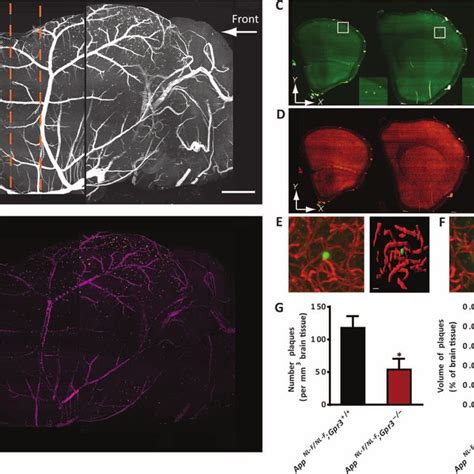 Pdf Loss Of Gpr Reduces The Amyloid Plaque Burden And Improves