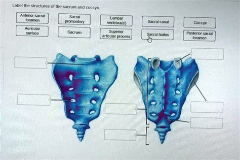 Solved Label The Structures Of The Sacrum And Coccyx Anterior