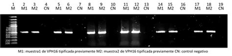 Optimización De Una Técnica De Pcr Convencional Para La Amplificación