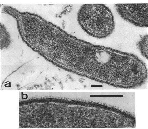 Thin Sectioning Of C Crescentus Na Wild Type S Layer A Note