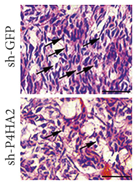 Knockdown Of P Ha Suppressed Tumor Xenograft Growth In Vivo A