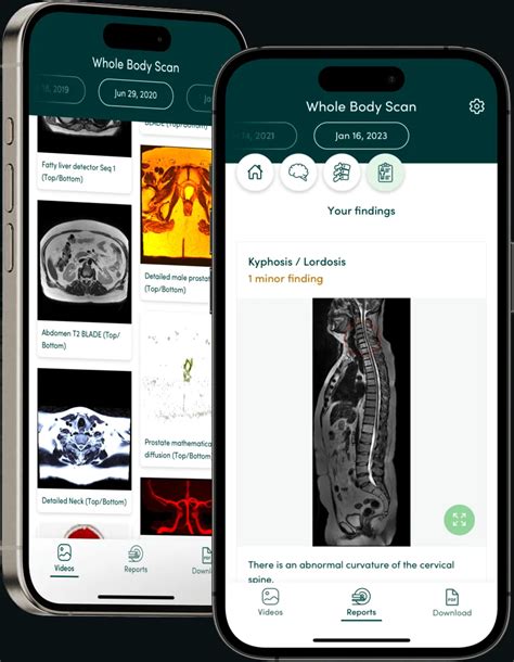 Whole Body Mri Scans Screen For 500 Cancers And Diseases Prenuvo