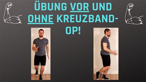 Kreuzbandriss Bung Vor Und Ohne Op Knie Stabilisieren Bzw Sp T