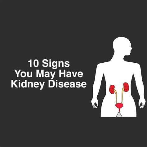 10 Signs You May Have Kidney Disease