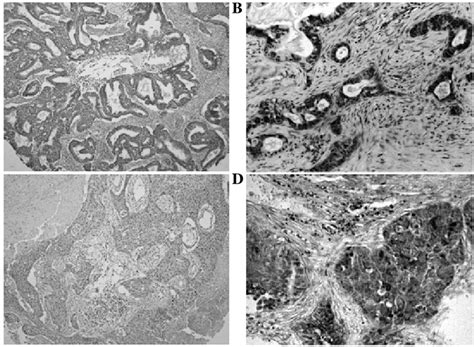 Immunohistochemical Staining Of Insulin Like Growth Factor Ii