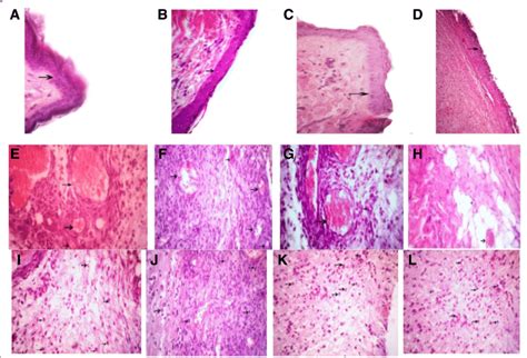 Arrows show the wound epidermis regeneration (a-d), vascular formation ... 