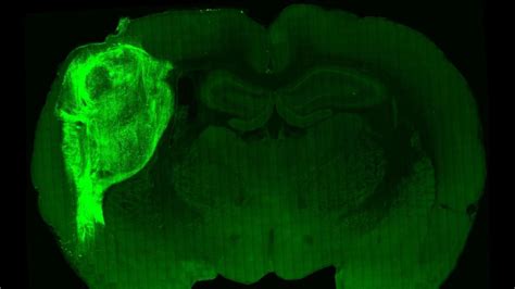 Tejido Cerebral Humano Implantado En Ratas Integrado Y Crecido Con El