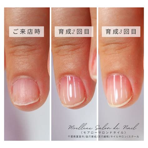 爪を綺麗に伸ばすには 自爪育成・深爪緩和nailsalon＋school 【千葉・富里・成田・八街】moelleux Salon De