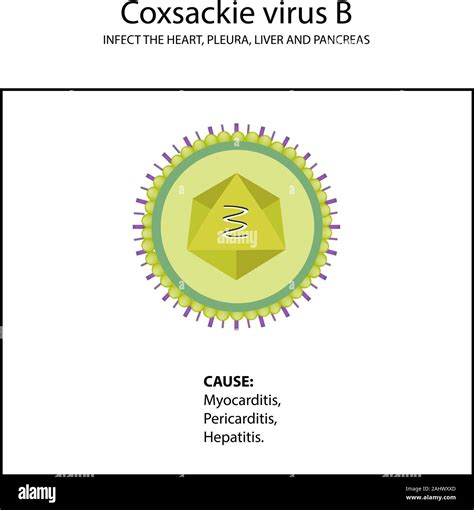 La Estructura Del Virus Coxsackie B Los S Ntomas De La Enfermedad