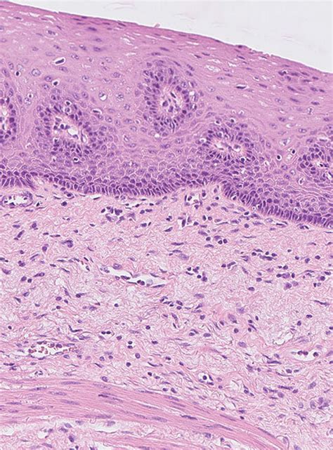 Histology Normal Esophageal Mucosa He Staining Download Scientific